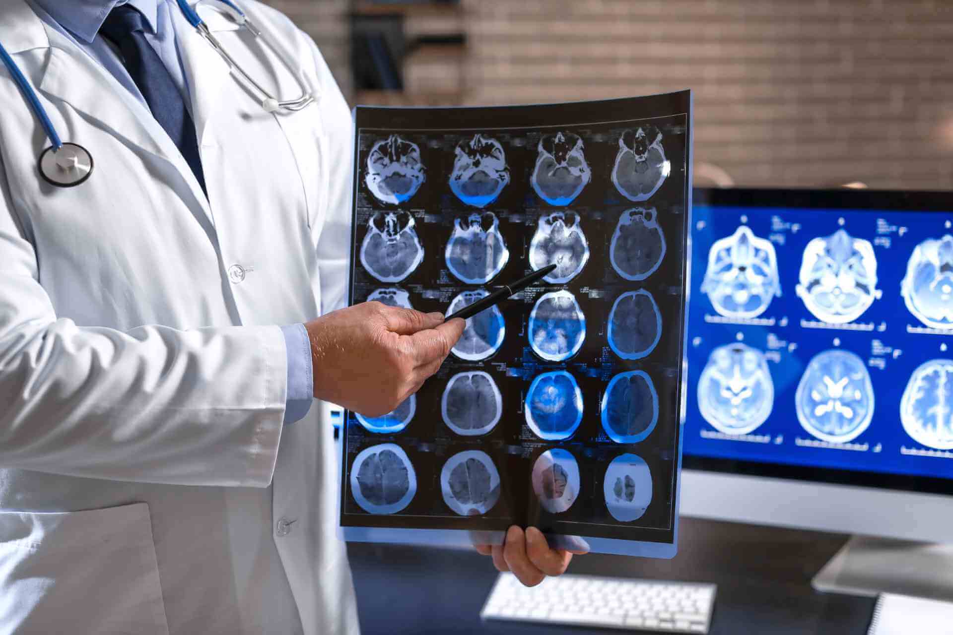 The Role of Neurologists in Comprehensive Brain Care